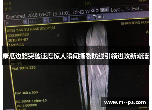 康瓜边路突破速度惊人瞬间撕裂防线引领进攻新潮流 康瓜边路突破速度惊人瞬间撕裂防线引领进攻新潮流